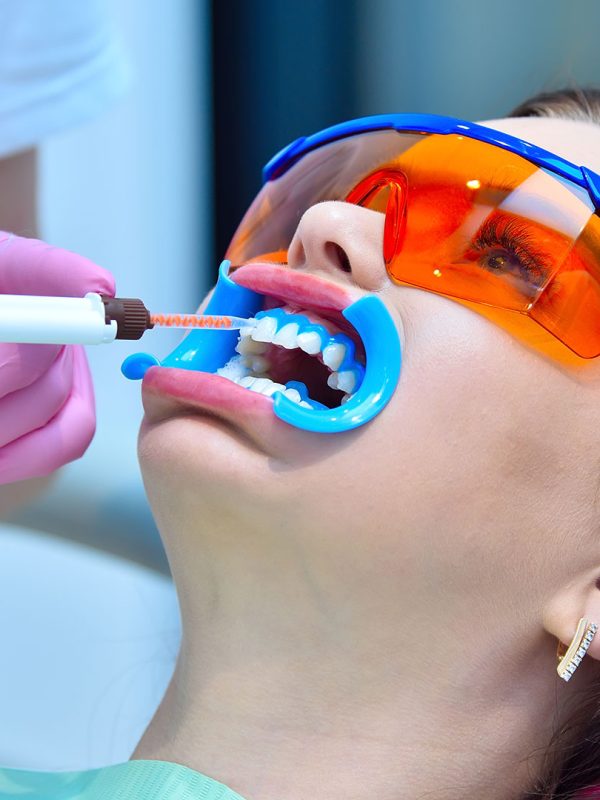 Dynamic Teeth Scaling